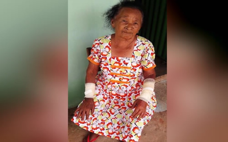 Mulher de 84 anos é esfaqueada pelo sobrinho de 42, em Missão Velha.