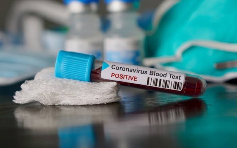 Porteiras registra primeiro caso de infecção pelo novo coronavírus