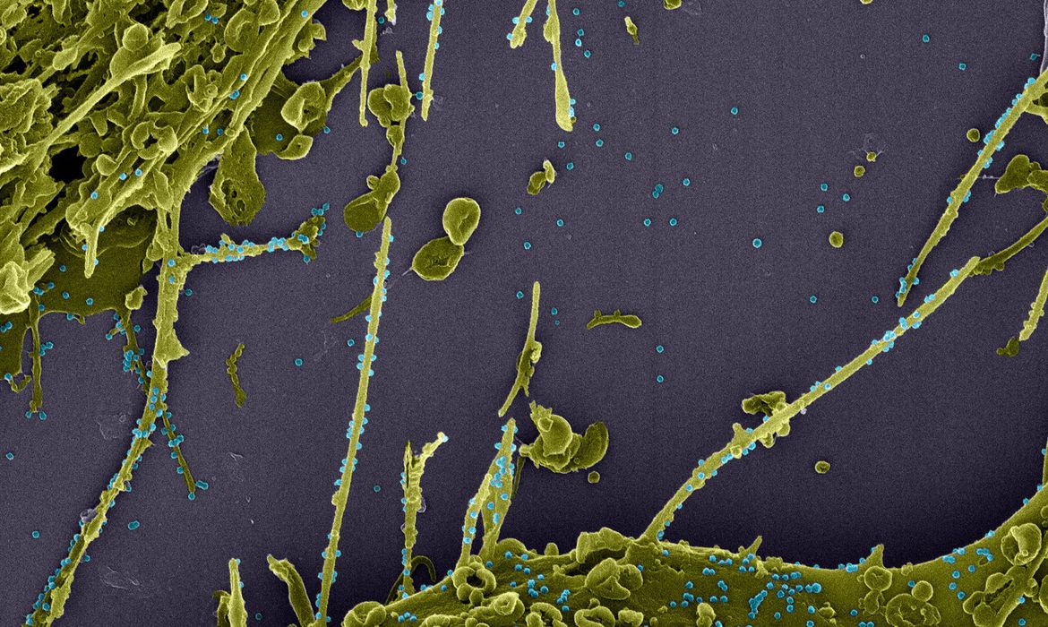 Estudo constata infecção simultânea por duas linhagens do coronavírus