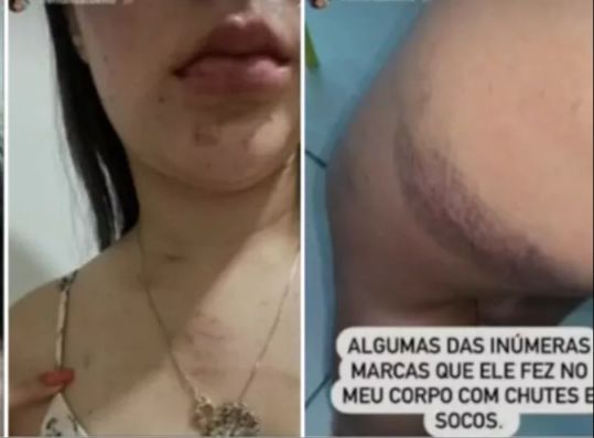 Polícia Civil indicia homem por lesão corporal contra ex-companheira em Barbalha