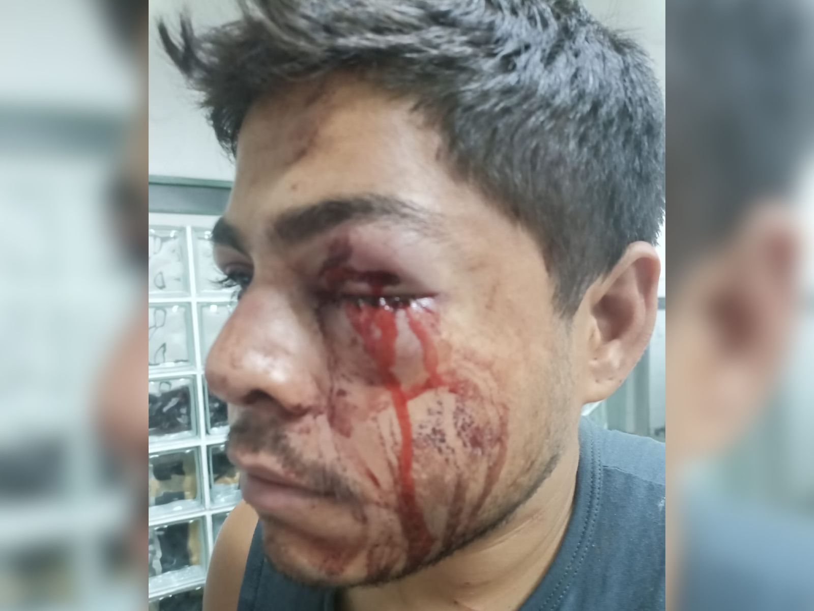 AO VIVO: homem relata caso de agressão sofrida no bairro Seminário, em Crato