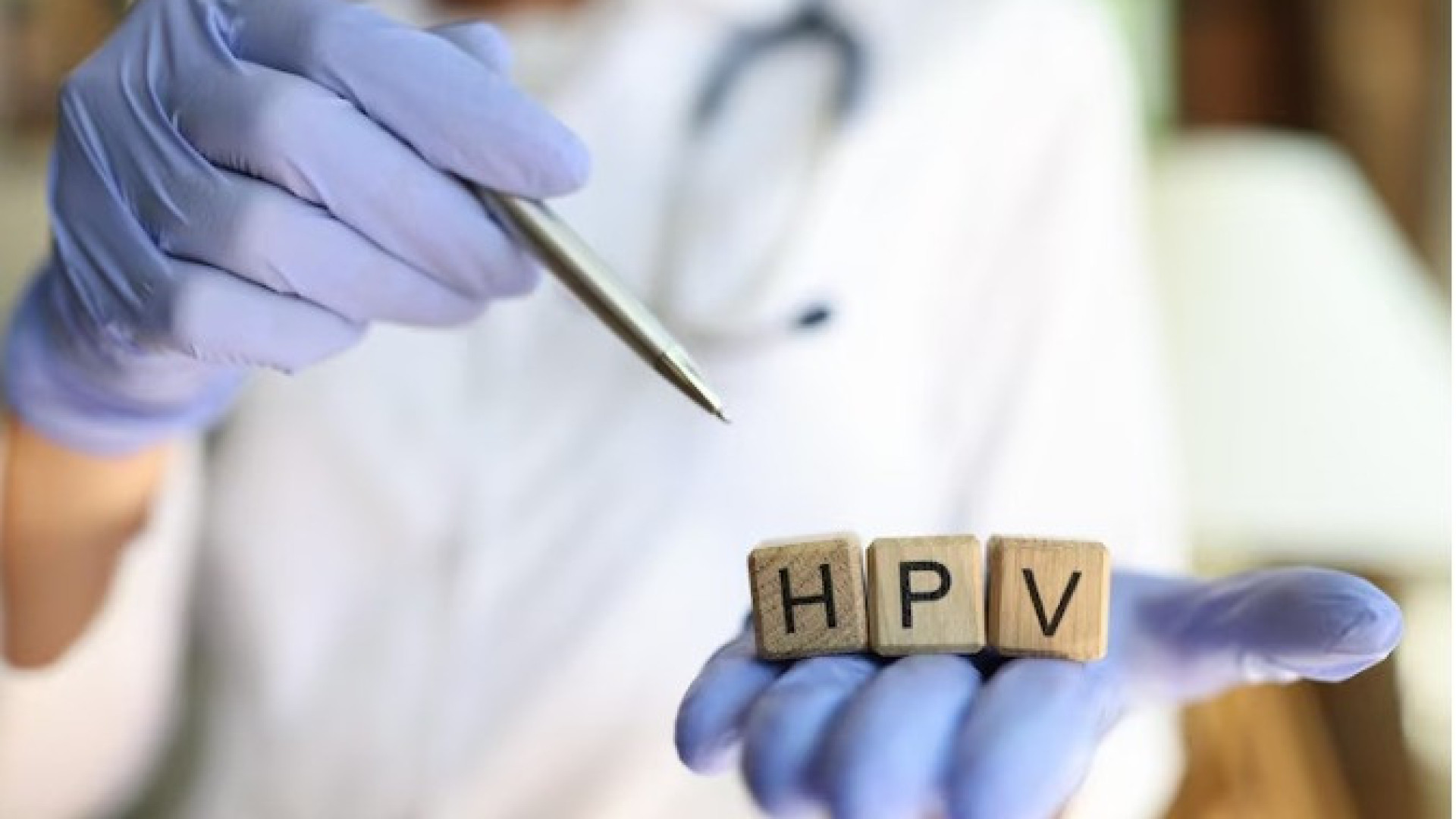 Estudo com teste de DNA para detecção de HPV tem resultado promissor