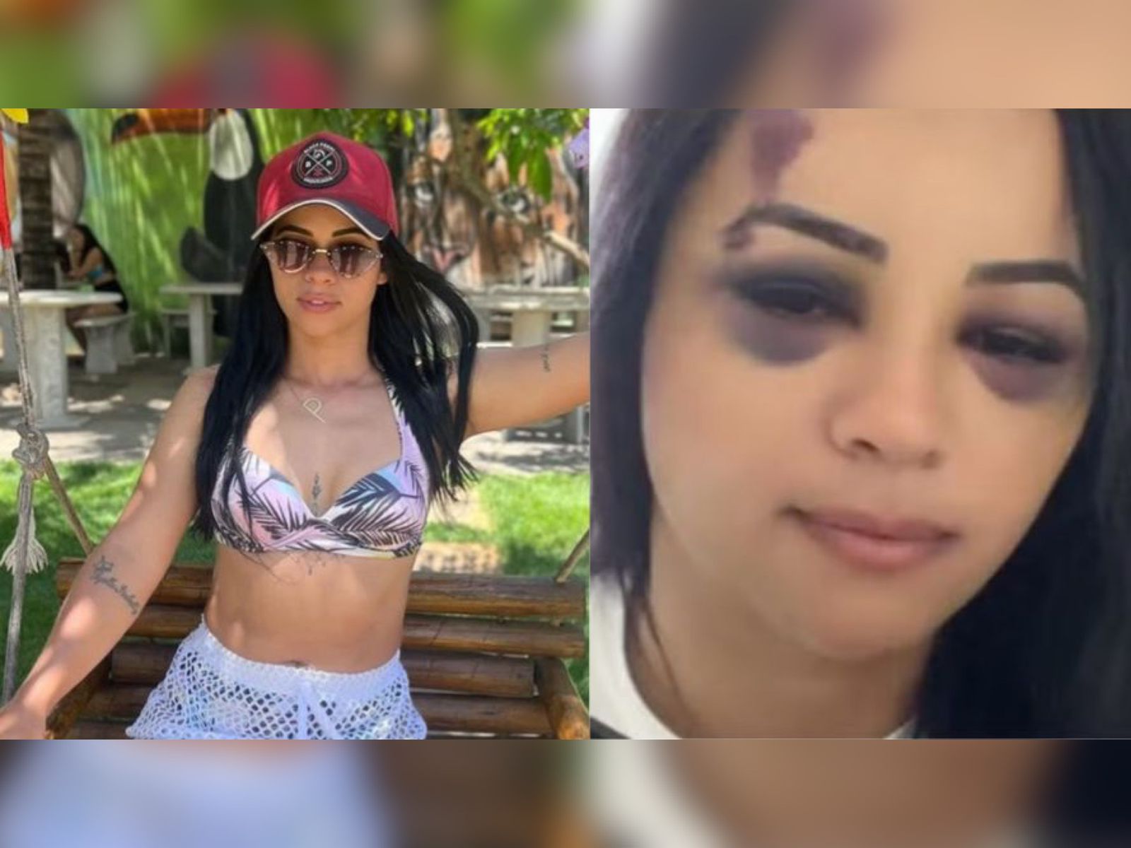 Influenciadora espancada pelo ex-marido com taco de sinuca em Araripe recebe alta; suspeito segue foragido